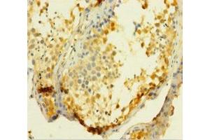 Immunohistochemistry of paraffin-embedded human testis tissue using ABIN7175117 at dilution of 1:100 (UCK1 抗体  (AA 1-201))