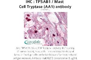 Image no. 1 for anti-Tryptase alpha/beta 1 (TPSAB1) antibody (ABIN1723155) (TPSAB1 抗体)
