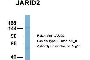 Host: Rabbit Target Name: JARID2 Sample Type: 721_B Antibody Dilution: 1. (JARID2 抗体  (N-Term))