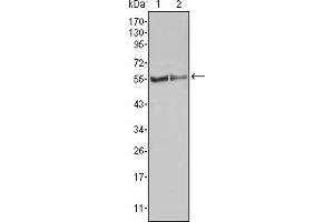 Western blot analysis using FGR mouse mAb against HL60 (1) Raw264. (Fgr 抗体)