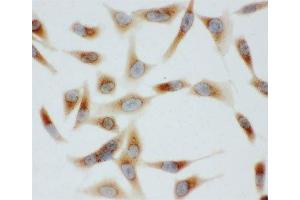 ICC testing of BiP antibody and HeLa cells (GRP78 抗体  (C-Term))