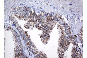 Image no. 6 for anti-NADH Dehydrogenase (Ubiquinone) 1 beta Subcomplex, 10, 22kDa (NDUFB10) antibody (ABIN1499672) (NDUFB10 抗体)