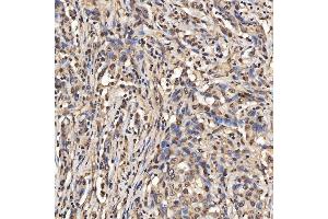 IHC analysis of SNRPA1 using anti-SNRPA1 antibody (ABIN7599131).