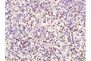 Formalin-fixed and paraffin embedded human spleen labeled with Anti CD75 Polyclonal Antibody, Unconjugated (ABIN704201) at 1:200 followed by conjugation to the secondary antibody and DAB staining. (ST6GAL1 抗体  (AA 301-406))