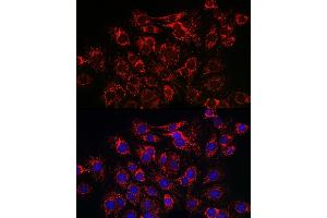 Immunohistochemistry of paraffin-embedded rat heart using SERC/ Rabbit pAb (ABIN3021429, ABIN3021430, ABIN3021431 and ABIN6215028) at dilution of 1:150 (40x lens). (ATP2A2 抗体  (AA 111-253))