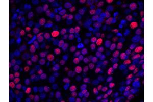 Immunofluorescence (IF) image for anti-Nuclear Casein Kinase and Cyclin-Dependent Kinase Substrate 1 (NUCKS1) (AA 1-50) antibody (ABIN7448993) (NUCKS1 抗体  (AA 1-50))