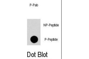 Dot Blot (DB) image for anti-Regulator of G-Protein Signalling 19 (RGS19) (pSer24) antibody (ABIN2971001)