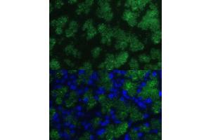 Immunofluorescence (IF) image for anti-Chymotrypsinogen B1 (CTRB1) (AA 79-263) antibody (ABIN7266398)