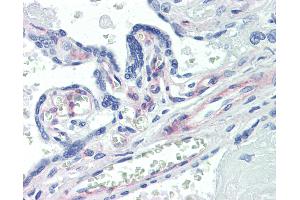 Anti-PDGFRB antibody IHC of human placenta. (PDGFRB 抗体)