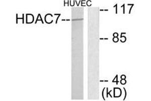 Western blot analysis of extracts from HuvEc cells, using HDAC7 Antibody. (HDAC7 抗体  (AA 901-950))