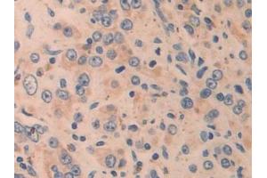 Immunohistochemistry (IHC) image for anti-Cysteine-Rich, Angiogenic Inducer, 61 (CYR61) (AA 178-381) antibody (ABIN7436243)