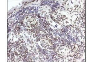 Image no. 3 for anti-Hydroxyprostaglandin Dehydrogenase 15-(NAD) (HPGD) antibody (ABIN363465) (HPGD 抗体)