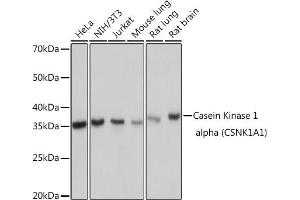 Western blot analysis of extracts of various cell lines, using Casein Kinase 1 alpha (Casein Kinase 1 alpha (CSNK1)) Rabbit mAb (ABIN7266098) at 1:1000 dilution. (CSNK1A1 抗体)