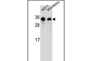 SAR1B Antibody (Center) (ABIN654355 and ABIN2844120) western blot analysis in MCF-7,MDA-M cell line lysates (35 μg/lane). (SAR1B 抗体  (AA 89-116))