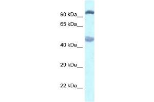 WB Suggested Anti-Egln2 Antibody   Titration: 1. (PHD1 抗体  (C-Term))