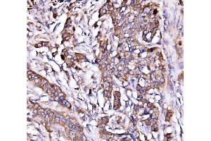 IHC analysis of ORP150/HYOU1 using anti-ORP150/HYOU1 antibody (ABIN7601807). (HYOU1 抗体  (AA 46-913))