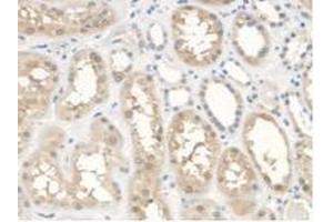 IHC-P analysis of Human Kidney Tissue, with DAB staining. (ANTXR2 抗体  (AA 34-318))