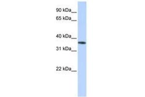 OR13C5 antibody  (C-Term)