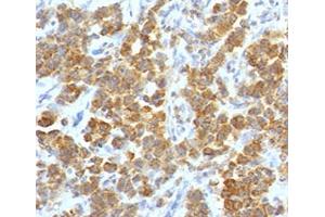 IHC testing of FFPE human parathyroid tumor with TL1A antibody (clone TLRM1-1). (TNFSF15 抗体)