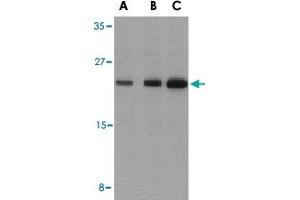 Western blot analysis of BAD in T24 cell lysates with BAD polyclonal antibody  at (A) 0.