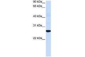 WB Suggested Anti-DRGX Antibody Titration:  0. (DRGX 抗体  (N-Term))
