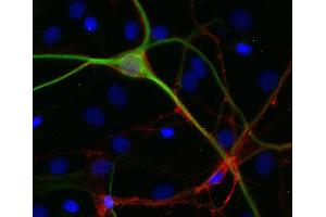 Indirect immmunostaining of PFA fixed rat hippocampus neurons with anti-GAP 43 (dilution: 1 : 500; red) and mouse anti-MAP 2 (cat. (GAP43 抗体)