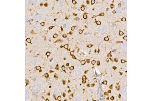 Immunohistochemistry of paraffin-embedded rat brain using Sterol carrier protein 2 Rabbit mAb (ABIN7270597) at dilution of 1:100 (40x lens). (SCP2 抗体)