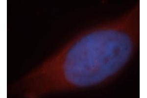 Immunofluorescence (IF) image for anti-Hepatic and Glial Cell Adhesion Molecule (HEPACAM) antibody (ABIN2932707) (HEPACAM 抗体)