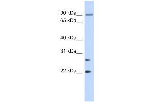 Western Blotting (WB) image for anti-Josephin Domain Containing 2 (JOSD2) antibody (ABIN2459544) (JOSD2 抗体)