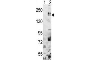 Western blot analysis of SETDB1 antibody and 293 cell lysate either nontransfected (Lane 1) or transiently transfected with the SETDB1 gene (2). (SETDB1 抗体  (AA 1193-1225))