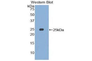 Western Blotting (WB) image for anti-Structural Maintenance of Chromosomes 3 (SMC3) (AA 994-1181) antibody (ABIN1860595)
