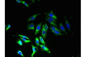 Immunofluorescent analysis of Hela cells using ABIN7173203 at dilution of 1:100 and Alexa Fluor 488-congugated AffiniPure Goat Anti-Rabbit IgG(H+L) (TMEM33 抗体  (AA 177-247))
