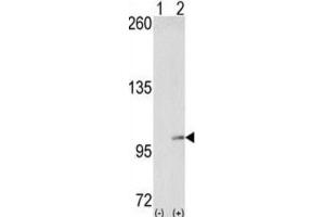 Western Blotting (WB) image for anti-EPH Receptor A4 (EPHA4) antibody (ABIN3003330) (EPH Receptor A4 抗体)
