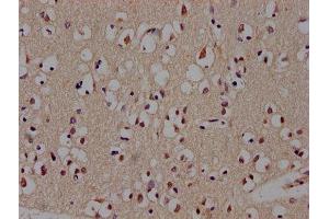 Immunohistochemistry of paraffin-embedded human brain tissue using ABIN7145172 at dilution of 1:300 (BCL11B 抗体  (AA 500-550))