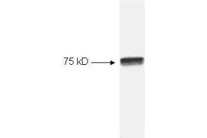 Image no. 1 for anti-Nuclear Factor-kB p65 (NFkBP65) (C-Term) antibody (ABIN221155) (NF-kB p65 抗体  (C-Term))