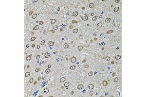 Immunohistochemistry of paraffin-embedded rat brain using EIF4A2 antibody. (EIF4A2 抗体  (AA 1-270))