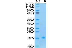 SDS-PAGE (SDS) image for Growth Differentiation Factor 15 (GDF15) (AA 197-308) protein (His tag) (ABIN7274723)