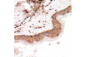 Immunohistochemical analysis of Cytokeratin 14/17 staining in human skin formalin fixed paraffin embedded tissue section. (Cytokeratin 14/17 抗体)