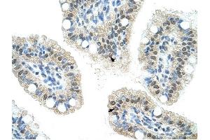NOL6 antibody was used for immunohistochemistry at a concentration of 16. (Nucleolar Protein 6 抗体)