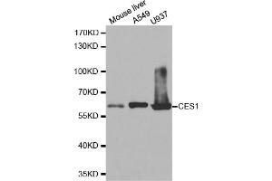 Western blot analysis of extracts of various cell lines, using CES1 antibody.
