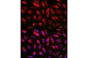 Immunofluorescence analysis of U2OS cells using TGF beta 1 antibody (ABIN7270909) at dilution of 1:150. (TGFB1 抗体  (AA 30-278))