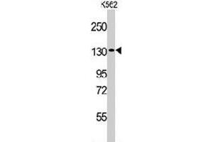 Western blot analysis of VARS polyclonal antibody  in K-562 cell line lysates (35 ug/lane).