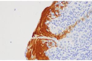 Immunohistochemistry of paraffin-embedded Human tonsil using S100A7 Polycloanl Antibody at dilution of 1:200 (S100A7 抗体)