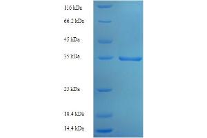 SDS-PAGE (SDS) image for Ephrin A1 (EFNA1) (AA 19-182) protein (His-SUMO Tag) (ABIN5709439)