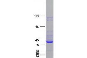 Validation with Western Blot (UCHL5 Protein (Myc-DYKDDDDK Tag))