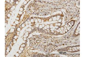 Immunohistochemistry (Formalin-fixed Paraffin-embedded Sections) (IHC (fp)) image for anti-N-Myc (And STAT) Interactor (NMI) (AA 1-100) antibody (ABIN522559)