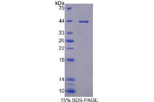 SDS-PAGE (SDS) image for Protein Kinase, X-Linked (PRKX) (AA 49-358) protein (His tag) (ABIN6237547) (PRKX Protein (AA 49-358) (His tag))
