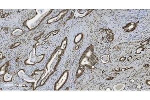 IHC analysis of U2AF65/U2AF2 using anti U2AF65/U2AF2 antibody (ABIN7600795). (U2AF2 抗体  (AA 238-470))