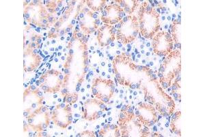 Used in DAB staining on fromalin fixed paraffin- embedded kidney tissue (TRAPPC10 抗体  (AA 1077-1259))