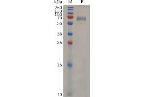 Mouse CD33 Protein, hFc Tag on SDS-PAGE under reducing condition